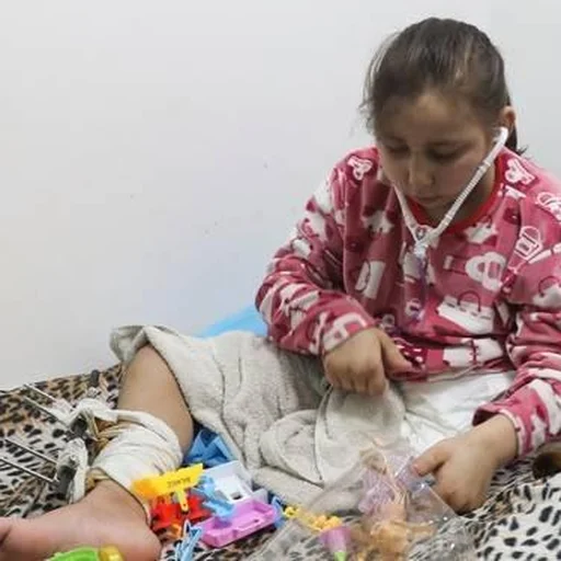 Gaza Conflict: 4,500 Amputations Recorded, Including 800 Children, Due to Israeli Attacks